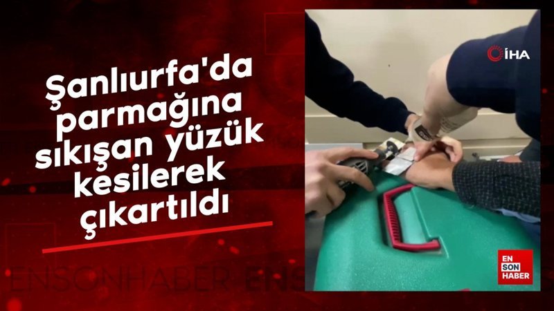 sanliurfada parmagina sikisan yuzuk kesilerek cikartildi WDp3au9d