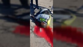 ankarada kamyonete carpan ehliyetsiz motosikletli yasam savasi veriyor RD3xJD32