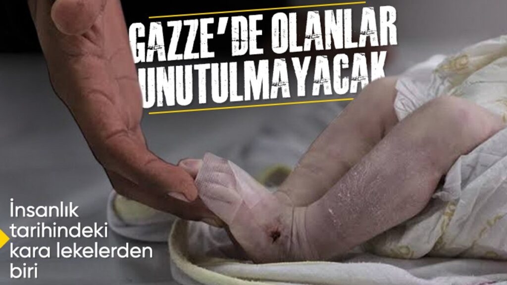 gazzede 470 gunun bilancosu onbinlerce can kaybi ve yikilan sehir m2KMFqL2