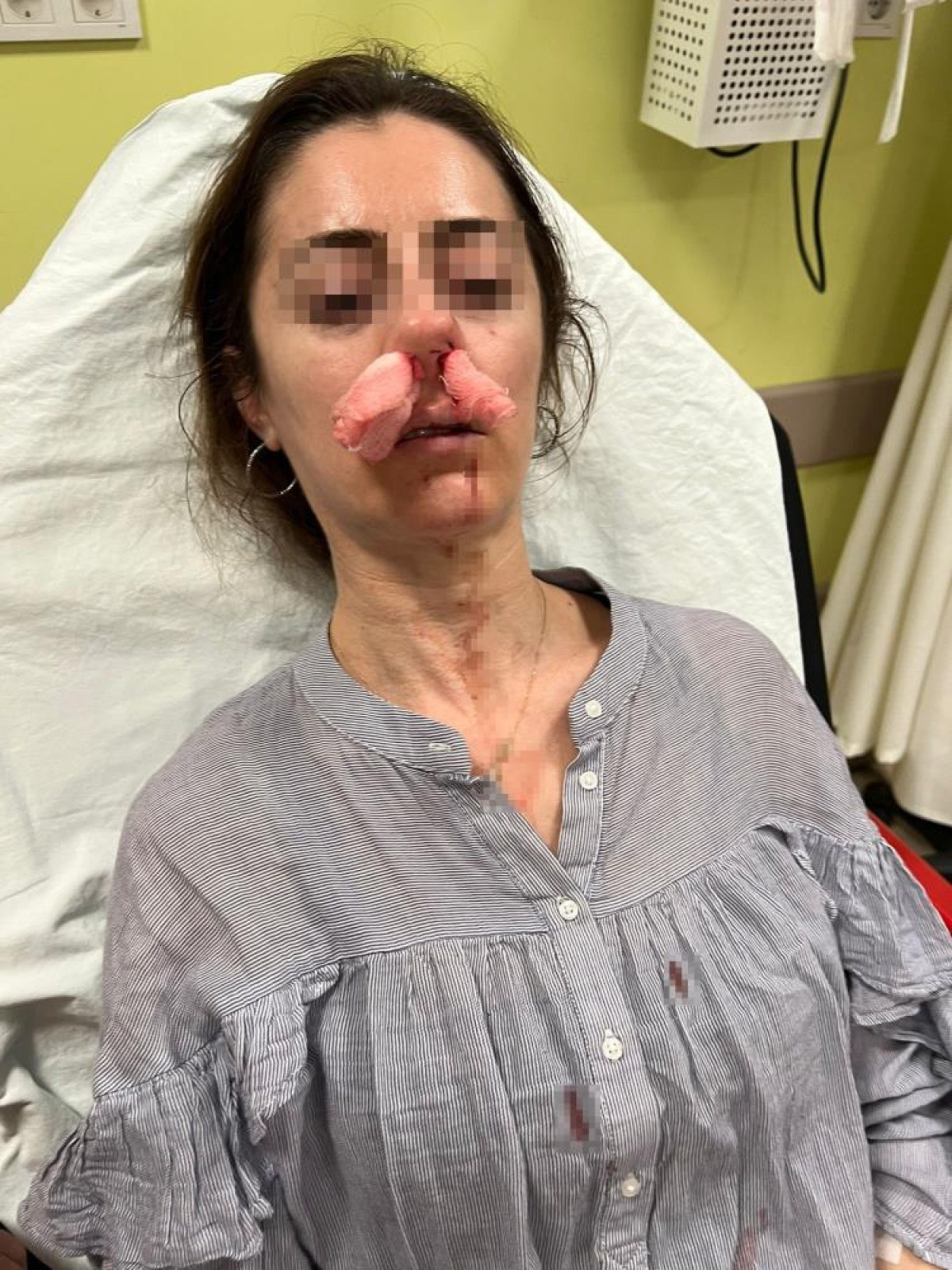 edirnede saskina ceviren olay kocasinin sevgilisine benzettigi kadini darbetti 0 4JD3GQfe