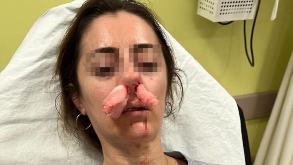 edirnede saskina ceviren olay kocasinin sevgilisine benzettigi kadini darbetti cxaUyr5v