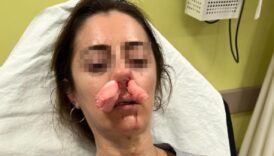 edirnede saskina ceviren olay kocasinin sevgilisine benzettigi kadini darbetti cxaUyr5v