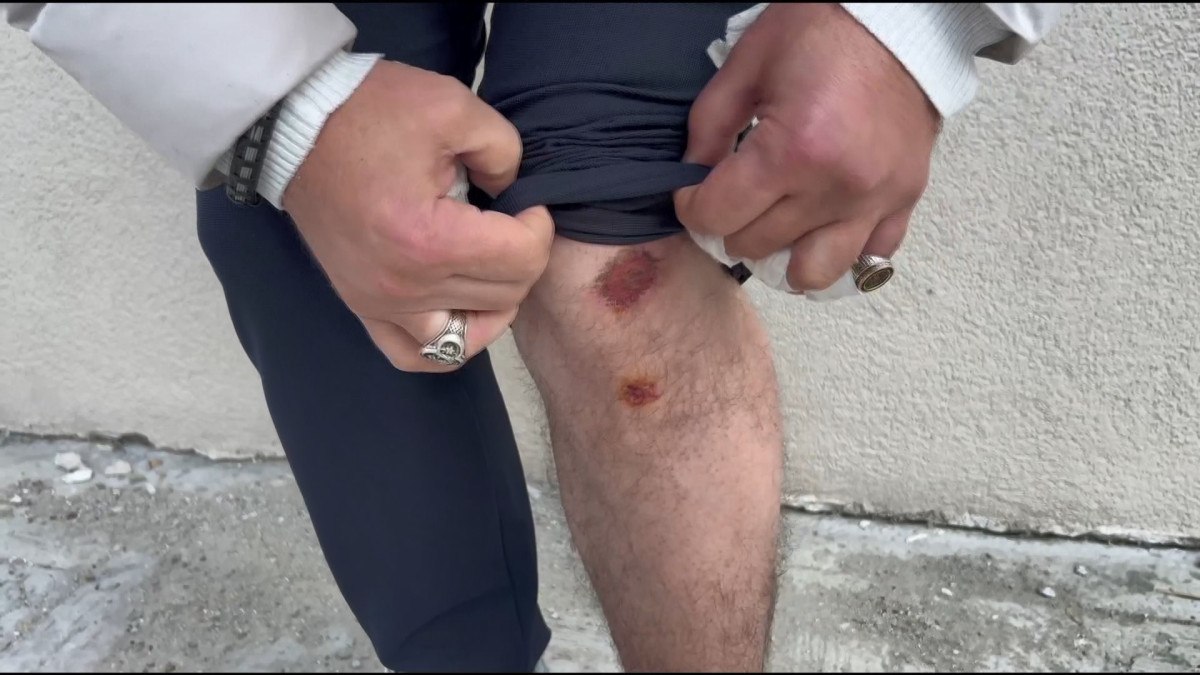esenyurtta sokakta beslenen kopekler yoldan gecenlere saldirdi 0 hZkeNK2F