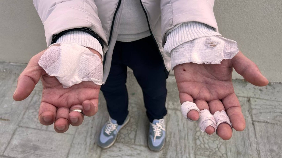 esenyurtta sokakta beslenen kopekler yoldan gecenlere saldirdi 4 pN6vjGzg