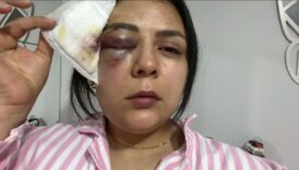 kahramanmarasta yururken saldiriya ugrayan genc kiz konustu EwRcqDLJ