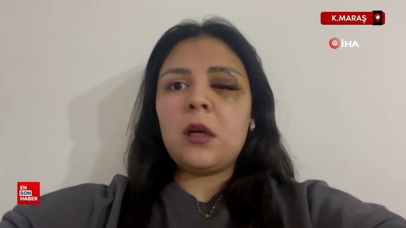 Kahramanmaraş'ta yürürken saldırıya uğrayan genç kız konuştu 1 kahramanmarasta yururken saldiriya ugrayan genc kiz konustu OzVuYDya