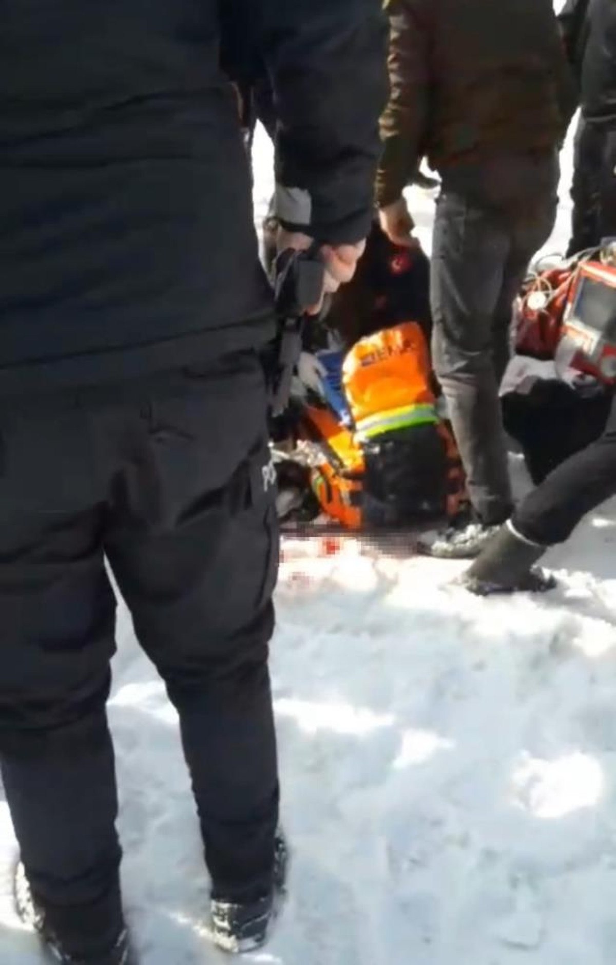 sokak kopeklerinin saldirisinda hayatini kaybetmisti ibrahim yumaklidan aciklama geldi 2 dkrQaNOv