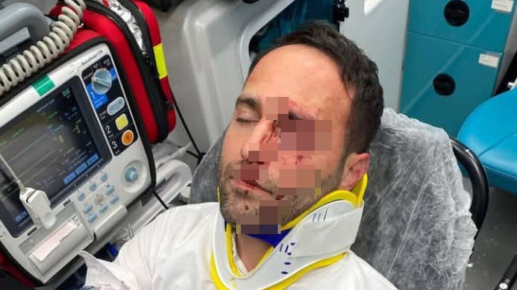 aksarayda darbettigi imami telle bogmaya calisti l4YTZKPR