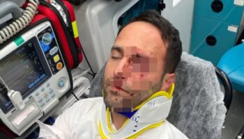 aksarayda darbettigi imami telle bogmaya calisti l4YTZKPR