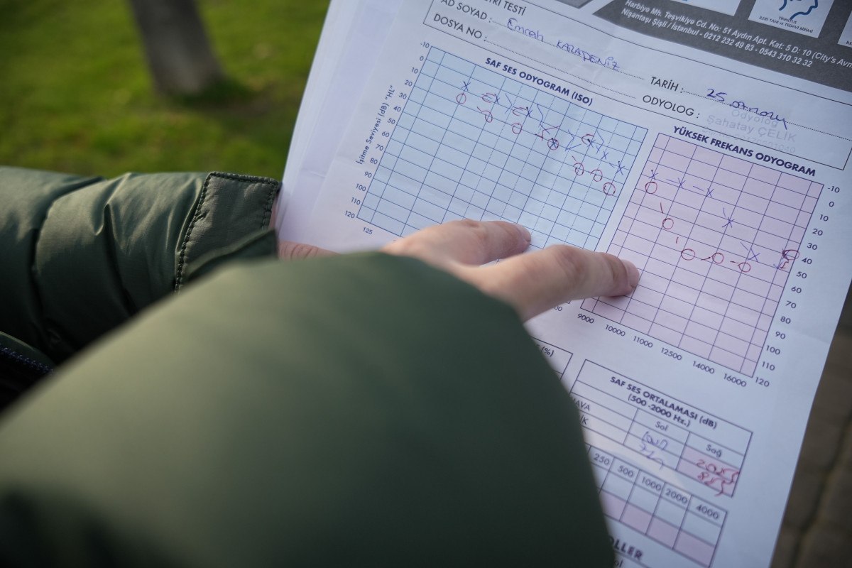 bursada sac ektirirken kulak zarini patlatti 0 4at477gI