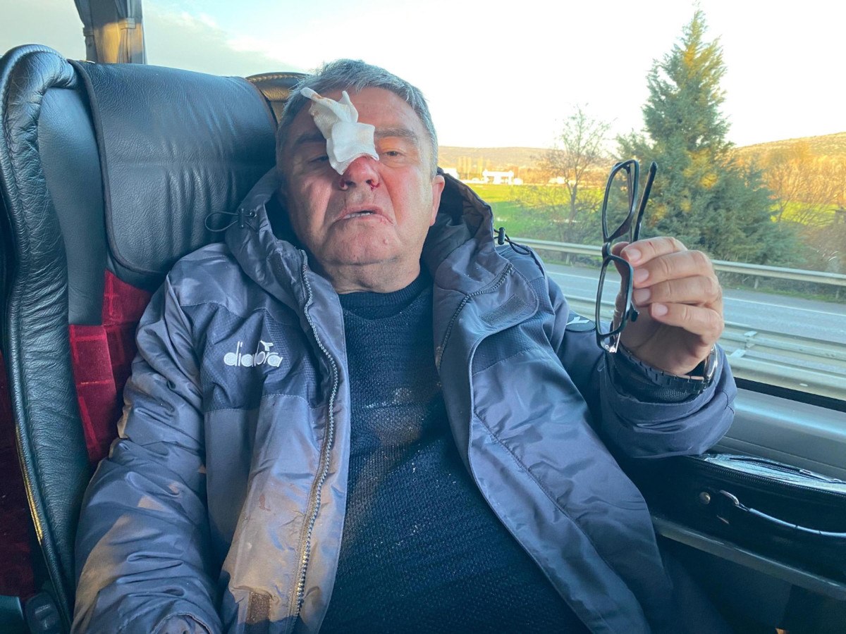 deplasman donusu saldiri sportif direktorun burnu kirildi 0 yMDPCRle