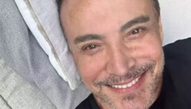 estetik olmustu yuzunu gerdiren sarkici cenk erenin son hali TZMNERd4