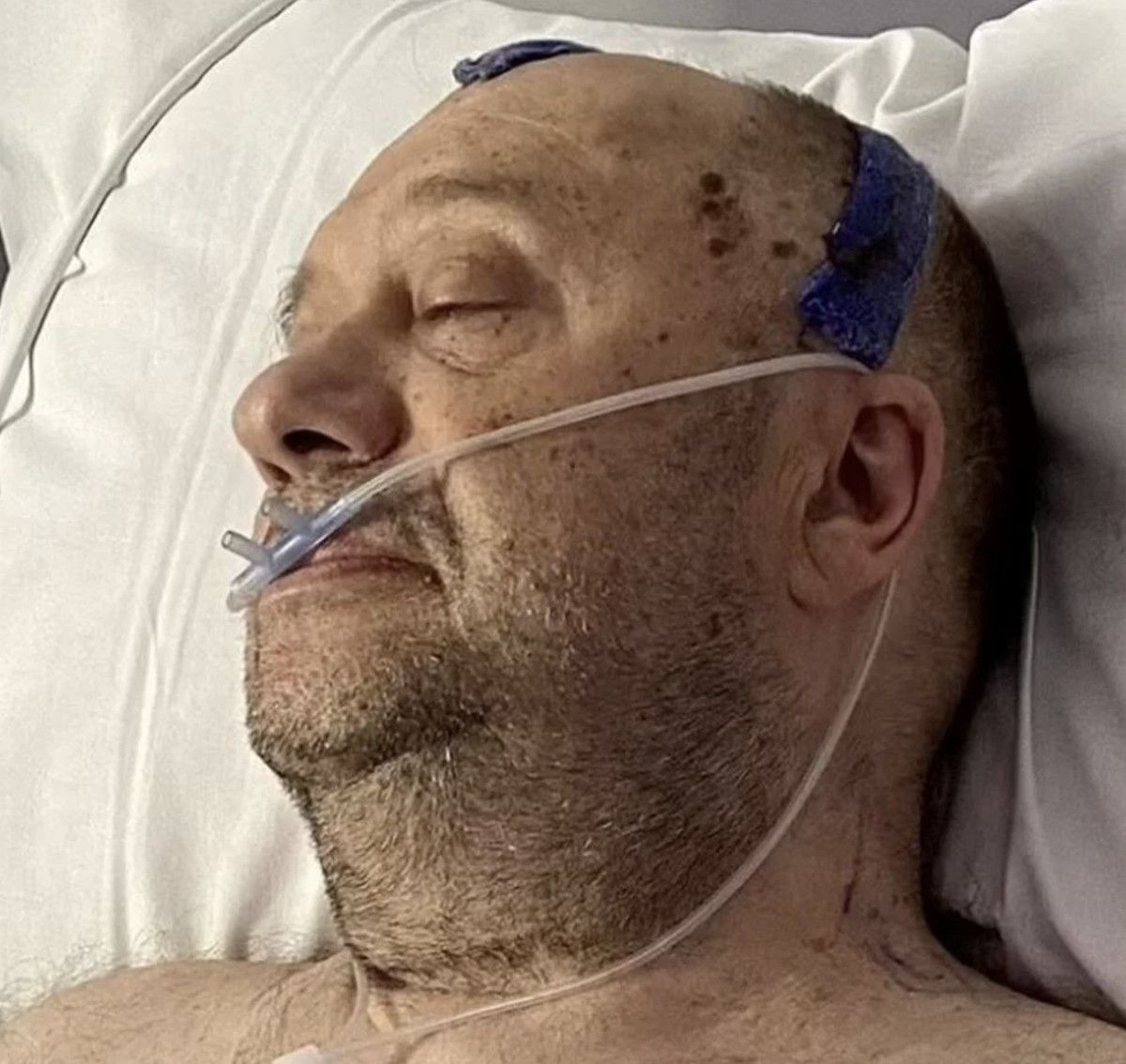 ingilterede yillardir depresyonda oldugunu saniyordu 7 santimetrelik tumor bulundu 0 nqiBI791